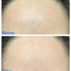 UOG Collagen Complex